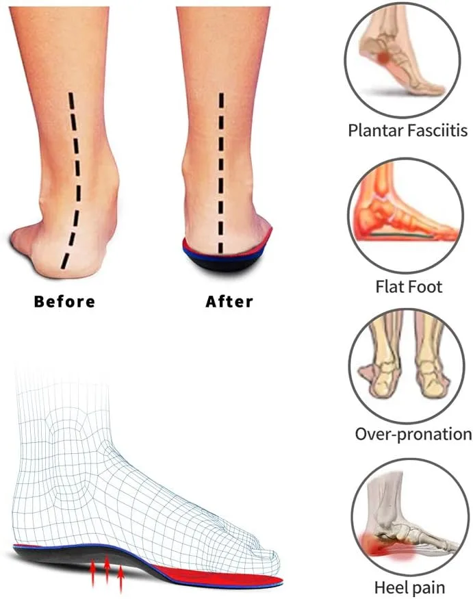 insoles for flat feet